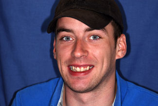 veneers_london_before